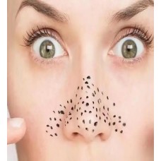 How to Manage Blackheads: Causes, Solutions, and Prevention